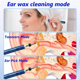 VITCOCO VITCOCO Ear Wax Removal Tool with Visual Tweezers, Ear Cleaner Kit with 2 Mode Ear Pick and Tweezers, Ear Camera Kit with Light, Earwax Remover Kit Otoscope for iOS,Android, Adults, Kids, Pets