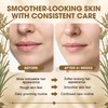 2 Pcs Cyperus Rotundus Oil for Hair Removal