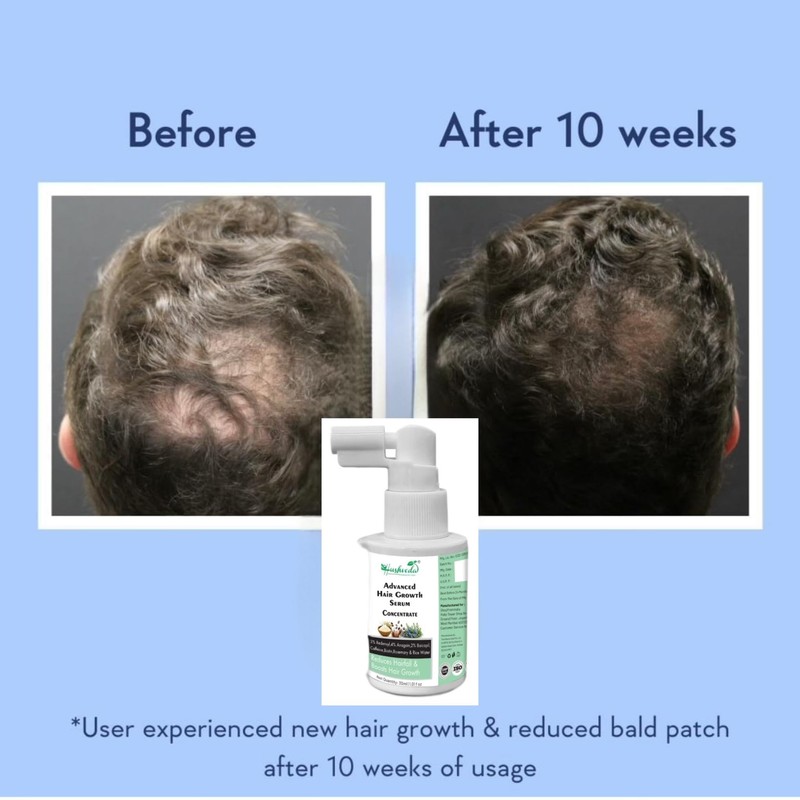 Hushveda Advanced Hair Growth Serum Concentrate 30ml Rosemary, 3% Redensyl,