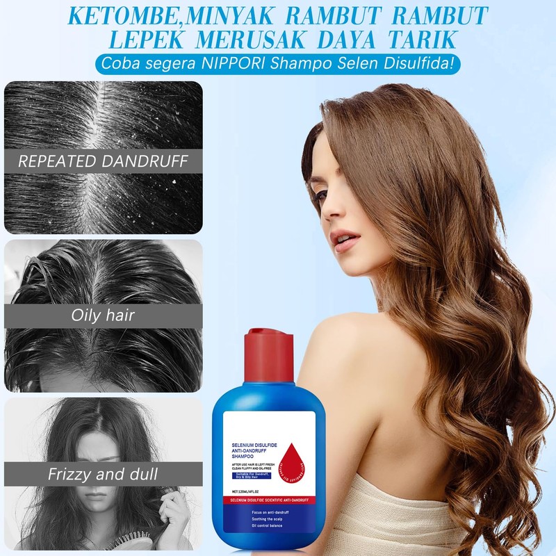 Viuvoiul Nipori Shampoo Anti，Nipori Dandruff Hair Care Shampoo - Oil