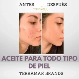 Aceite Óleo Facial Reparador Terramar De 30ml