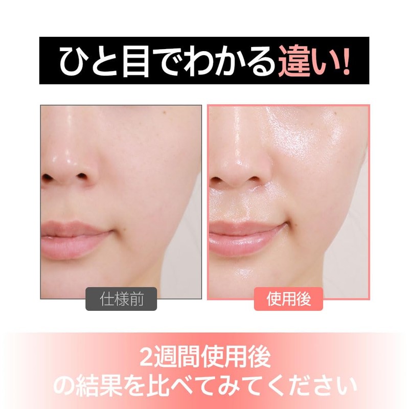 NUDIQUEスピテラパーミアPDRNクリーム50ml ハリ しわ 弾力 保湿 毛穴ケア バリア