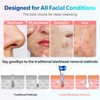 Blackhead Remover Pore Vacuum Upgraded Facial Pore Cleaner Electric Comedone