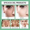 Creme De Ácido Azelaico Essência Facial 30g Anti-acne