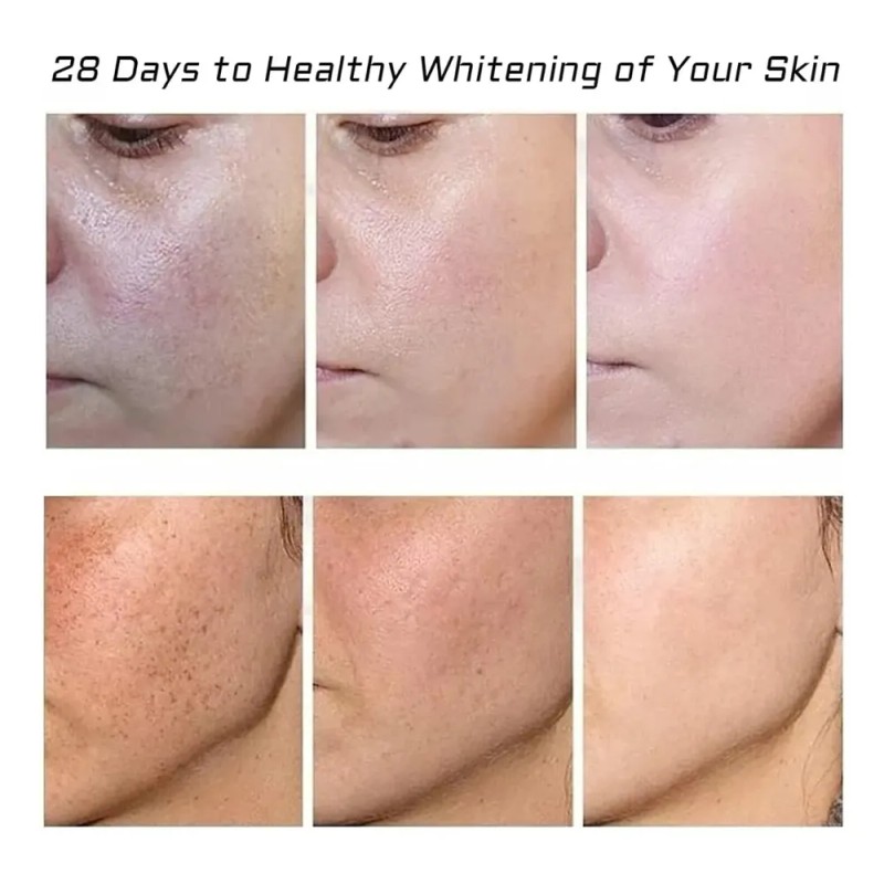 Crema Facial Despigmentante Y Anti Manchas Pack 2 Pzs Todo