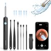 Medcursor Ear Wax Removal, Ear Wax Removal Tool Camera with