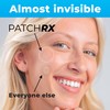 PatchRx Pimple Patches for Face (120 Patches), Hydrocolloid Acne Patches