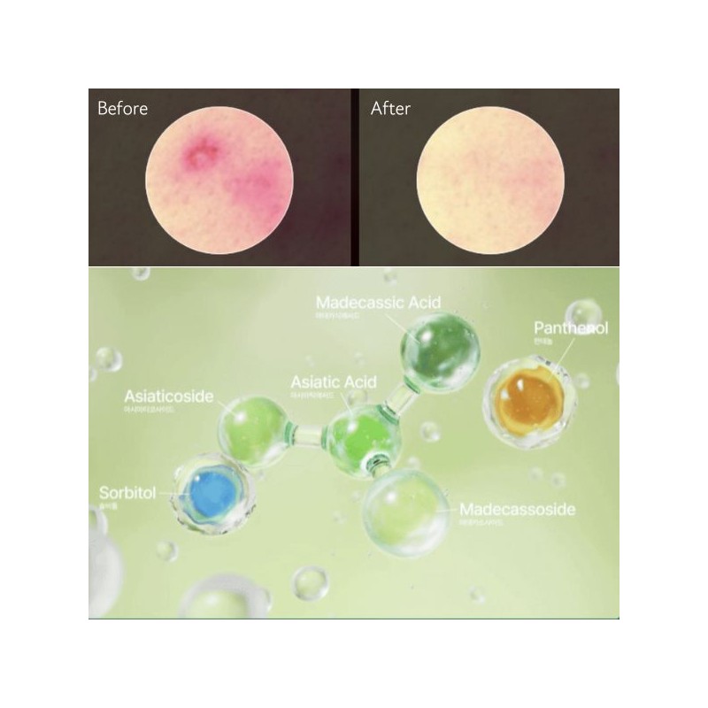 Anua Heartleaf Centella Red Spot Cream 30g