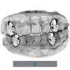Big Dawgs Bling Custom Fit Silver Plated Iced CZ Mouth Tooth Teeths Grillz Caps Set of 4