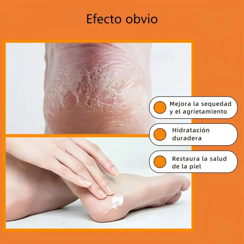 Fd Crema Hidratante Exfoliante Para Pies Secos Y Agrietados