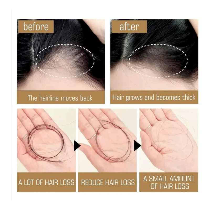 Fg Champú Remimpi, Adecuado Para Todo Tipo De Cabello,1