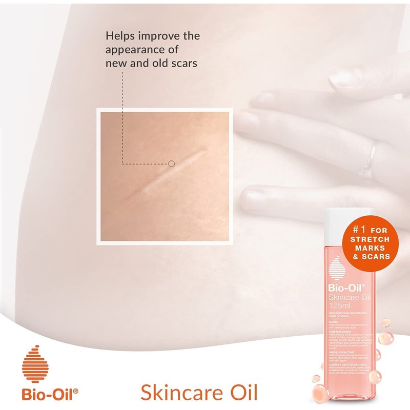 Bio-Oil Skincare Oil - Improve the Appearance of Scars, Stretch