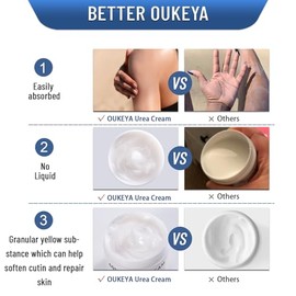 OUKEYA Crema de Urea 40% con Glicerina y Vitamina E 150g | Urea 40%, Glicerina, Vitamina E, Hidratación Corporal, Cuidado de Pies, Talones y Manos, Us