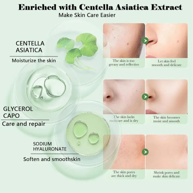 Set Mopoyat Kit Control De Acne Centella Asiatica