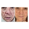 Crema Facial L2hcare Hidratante, Desmanchadora Y Antiarrugas