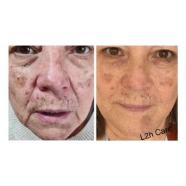Crema Facial L2hcare Hidratante, Desmanchadora Y Antiarrugas