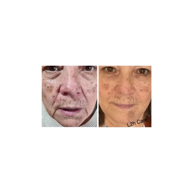 Crema Facial L2hcare Hidratante, Desmanchadora Y Antiarrugas