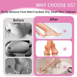 MOWLIE Electric Foot Callus Remover,MOWLIE Electric Foot Care Tools with Speed Controller and 60pcs Replacement Sandpaper Disk for Men Women Dead Dry Crack Skin Calluses (pink-11)