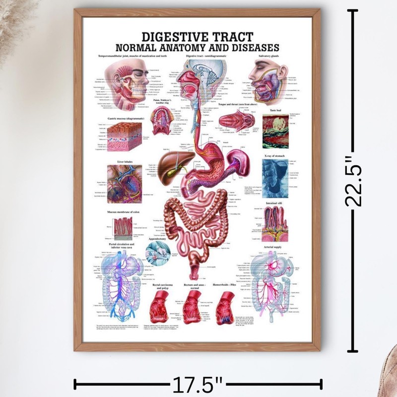 Anatomical Worldwide The Digestive Tract Normal and Diseased Laminated Anatomy
