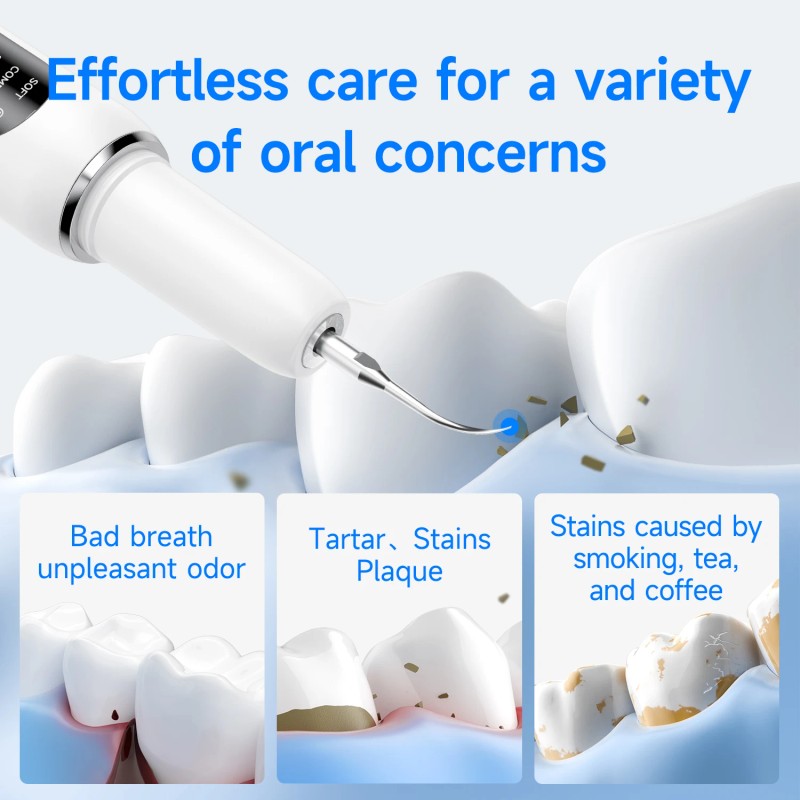 Electric Ultrasonic Teeth Cleaner Calculus Stain Remover Effective Oral Tooth