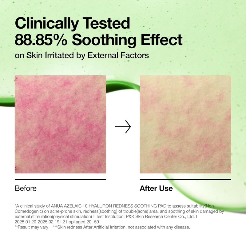 Anua [Anua]Azelaic Acid 10 Hyaluron Redness Soothing (90ea)