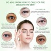 Aichun Beauty Dark Eye Circles Wrinkles Cream Natural Moisturizing Aloe