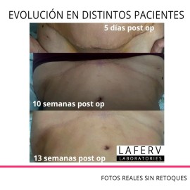 Crema Post Operación Cicatrizante Abdominoplastia Acné 2 Pza