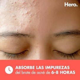Hero Parches para Acné Mighty Patch Original, Caja con 36 Piezas para Uso de Noche. Absorben las Impurezas en 6 a 8 Horas. Fáciles de Usar y No Contie