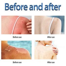 Sun Cream SPF 100,Sunscreen SPF 100+ PA+++,UVB/UVB High Protection SP/F 100 Face Moisturiser,Broad Spectrum Uv Protection For Face/Body,Waterproof Fac/e Sunscreen,Non-Greasy Suncream Factor 100