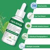 3 Pack 5% Niacinamide Serum with 4% Tea Tree Extracts
