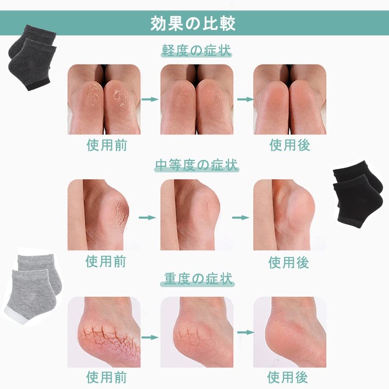 DFsucces Heel Care Socks, Heel Moisturizing, Exfoliating Care, Cracking, Smooth,