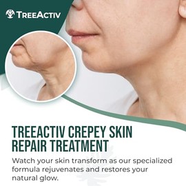 TreeActiv Tratamiento reparador de piel Crepey, fórmula original, 8 fl oz, crema reafirmante para rostro y cuello, loción reafirmante para la piel con