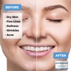Beauty Facial Detox Mask – Mini Face Mask for Deep