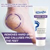 ClearZal Foot Cream For Hard Skin, Helps Calluses and Corn