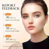 Sérum Facial Con Vitamina C, Antioxidante, Brillo, Antiacné,