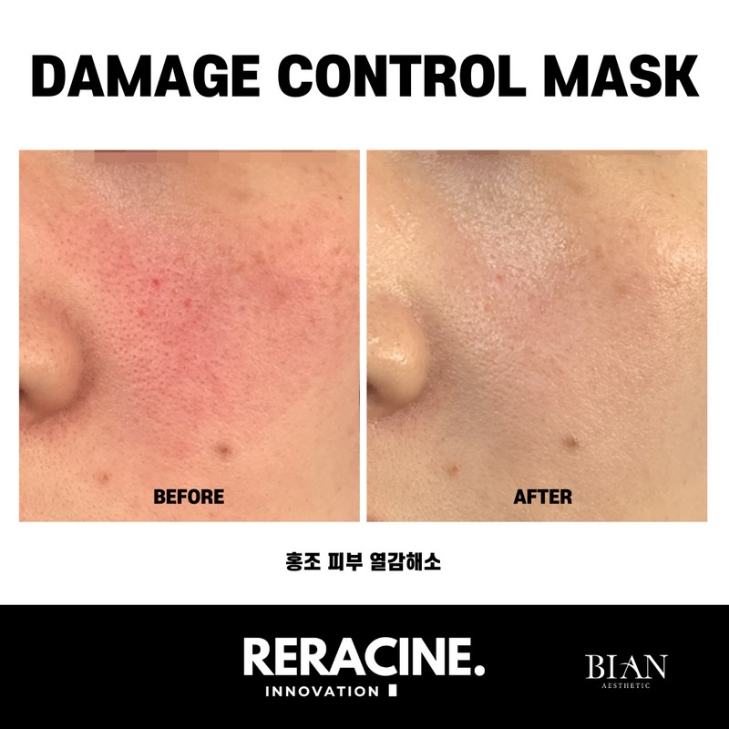 Lyricin Liracyn Damage Control Cooling Mask Pack (5 sheets per