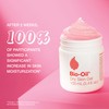 Bio-Oil Travel Skincare Bundle for Scars, Stretch Marks, and Dry