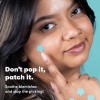 Parches Antiacné Proactiv Zits Happen Design, Tratamiento Hi