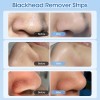 80x LANBENA Pore Strips Blackhead Remover Cream Nose Acne Clean