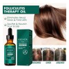Aceite De Foliculitis Del Cuero Cabelludo, Natural Y Nutriti