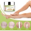 Purvigor Crema Para Eliminar Rápido Las Varices Y Arañitas Vasculares