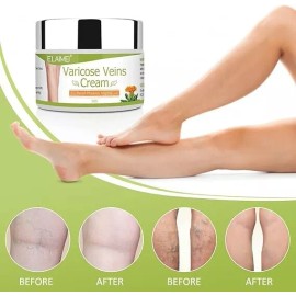 Purvigor Crema Para Eliminar Rápido Las Varices Y Arañitas Vasculares Natural [from Usa]