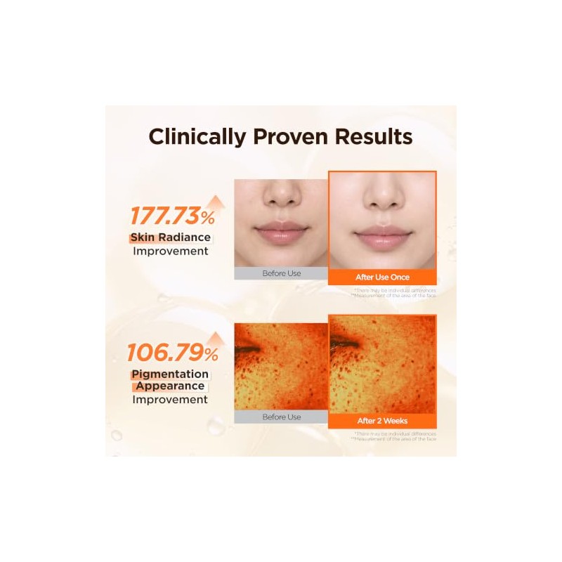 Dermal Mascarilla de Hidrogel de Vitaminas Fundente en Gel(4 Unidades)