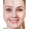 Erinde Foundation Colour Changing, Colour-Changing Foundation for Mature Skin, Concealer