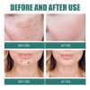 Crema Eliminadora De Pecas Y Blanqueamiento Hd Xifei