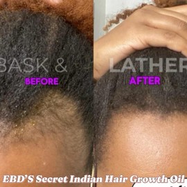 EBD’s Secret Indian Hair Growth Oil - Haircare Treatment for Enhanced Comfort and Growth - Size: 50ml