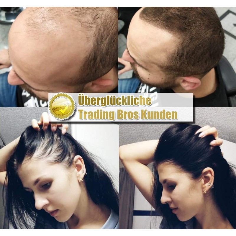 XXL Premium Scattered Hair Thickening Trading Bros Magic Hair Fibres
