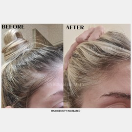 Emunah Beauty Hair Growth Oil Scalp Treatment