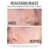 SERUM CONTROLDE POROS ANTI-COMEDONES