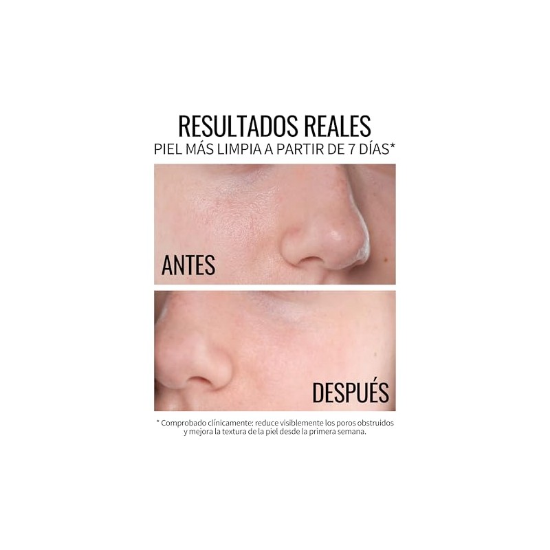 SERUM CONTROLDE POROS ANTI-COMEDONES